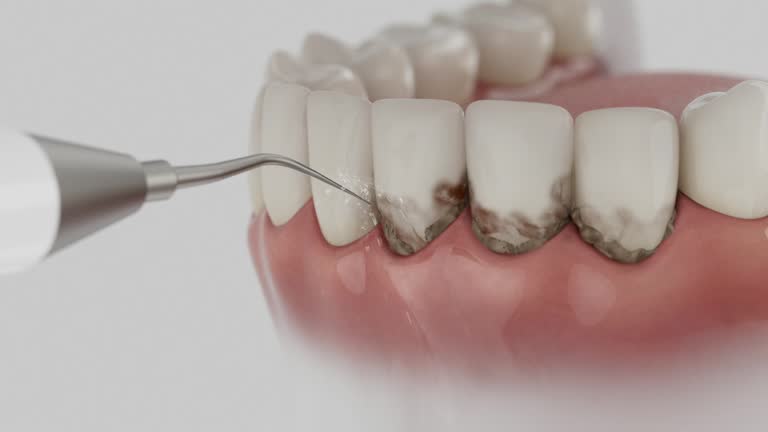 Trusted Emergency Dentist service in Bay Village, OH - Dentist Open Now